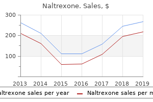 cheap naltrexone 50mg on-line
