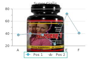 trusted 80 mg super cialis