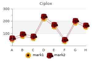 cheap ciplox 500 mg free shipping