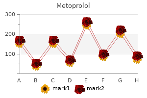 cheap metoprolol online