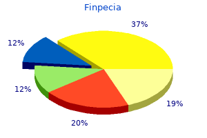 purchase finpecia online now