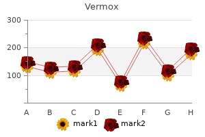 buy vermox 100mg without a prescription