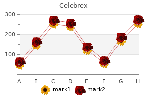 buy cheap celebrex 200 mg online
