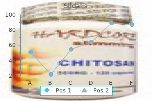 buy 120 mg sildalis