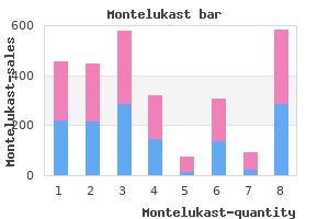 order montelukast 4mg amex