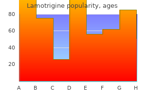 purchase discount lamotrigine on line