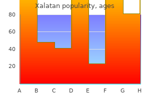 buy xalatan 2.5ml amex
