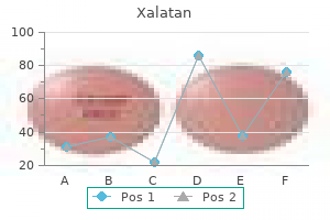 order 2.5ml xalatan amex