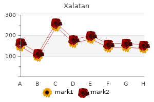 buy cheap xalatan 2.5 ml on line