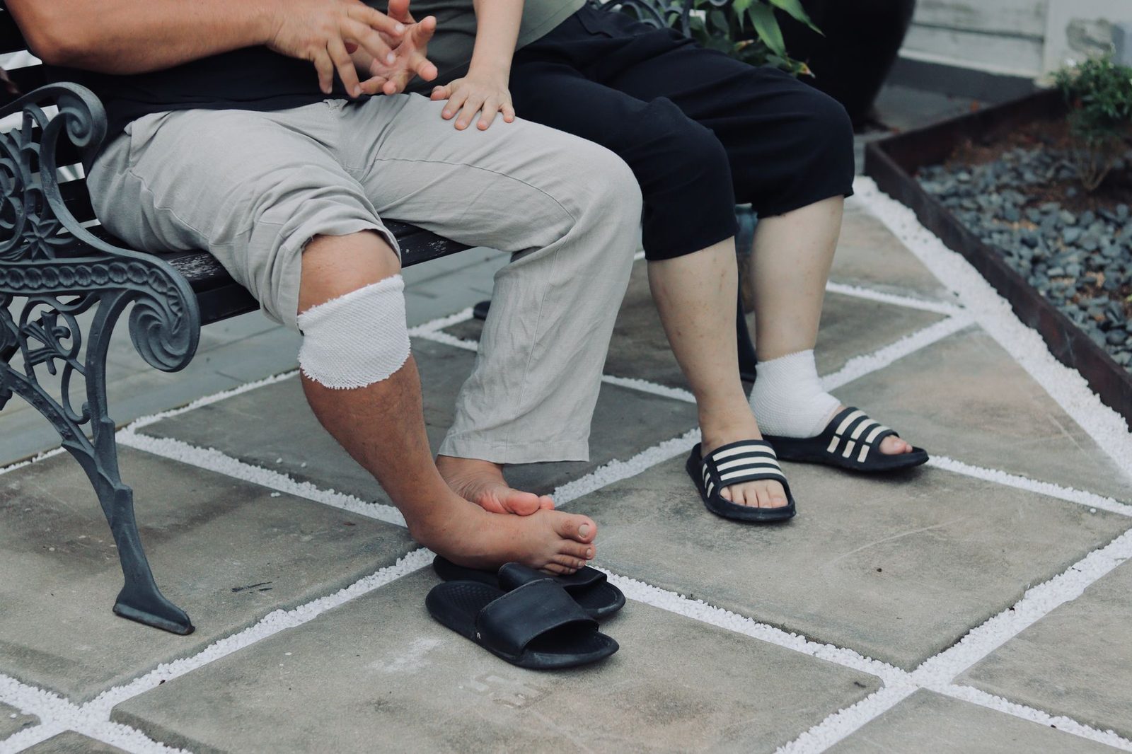 Couple sitting on a bench with bandaged legs, outdoors in a patio setting, indicating leg injuries.