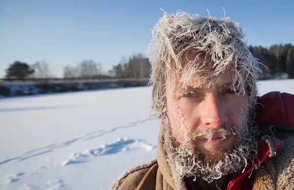 First Aid for Preppers – Part 3: Shock, Heatstroke & Hypothermia