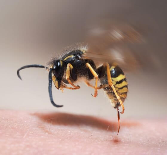 bee stinging, first aid